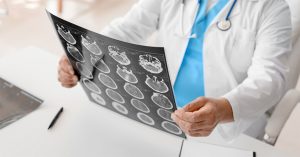 Capturing Mental Health with Imaging Technology