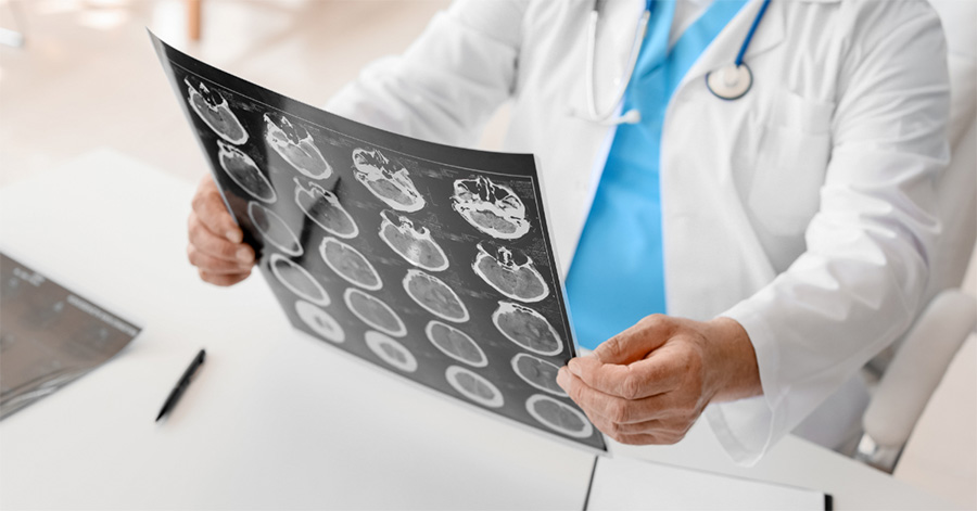 Capturing Mental Health with Imaging Technology